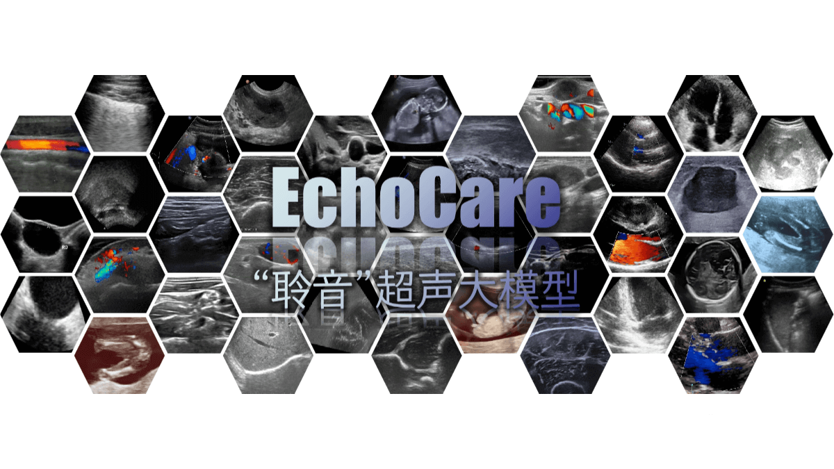 Lingyin EchoCare – an ultrasound foundation model launched by the Chinese Academy of Sciences, Hong Kong